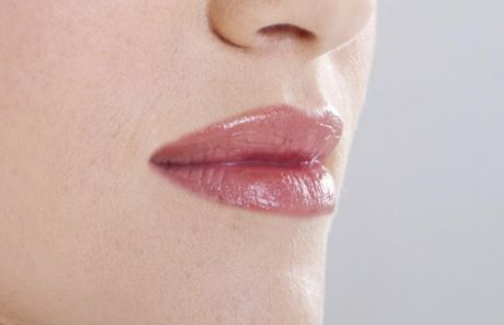 廣醫(yī)一院整形美容科：醫(yī)生實力強，雙眼皮案例為佐證