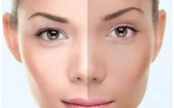 長(zhǎng)沙醫(yī)療機(jī)構(gòu)優(yōu)質(zhì)整鼻手術(shù)服務(wù)