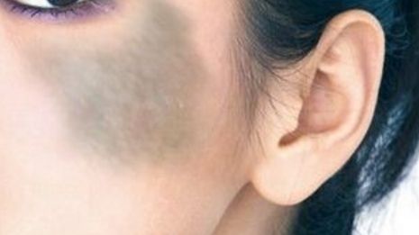 鎮(zhèn)江隆鼻醫(yī)院推薦：鎮(zhèn)江做隆鼻，這幾家醫(yī)院不可錯(cuò)過！