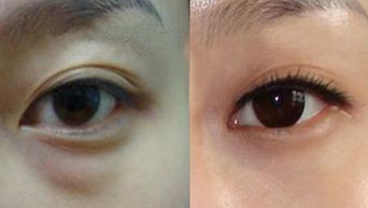 廣州哪家整形醫(yī)院最受好評(píng)？TOP3推薦！