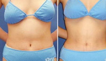 衡陽比較好的醫(yī)院美容科專家團隊推薦，價格公開透明！