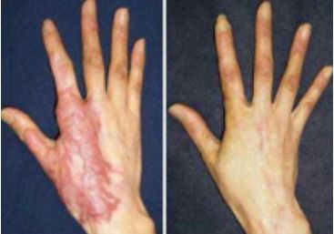 深圳市綜合整形醫(yī)院排行榜，口碑好的醫(yī)療機構(gòu)大揭秘！