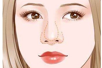 濟南哪家醫(yī)生做雙眼皮效果好？謝燕燕醫(yī)生實力及案例揭秘！