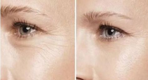 2023最佳杭州雙眼皮整形醫(yī)院排行榜揭曉！讓你雙眼瞬間變迷人的十大選擇！