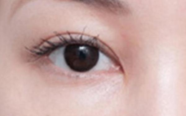 博愛醫(yī)院的雙眼皮效果如何？賈維順、許國明醫(yī)生資歷詳解