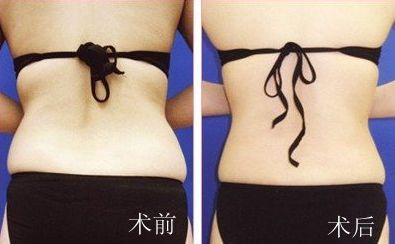 廣州非常受歡迎的整形專家解密！揭秘絕頂名醫(yī)，為你帶來全新穎解析！