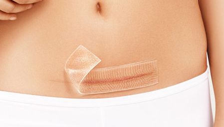 上海九院王琛隆鼻術(shù)后圖及專家簡(jiǎn)介，完成理想的鼻梁不再遙不可及！