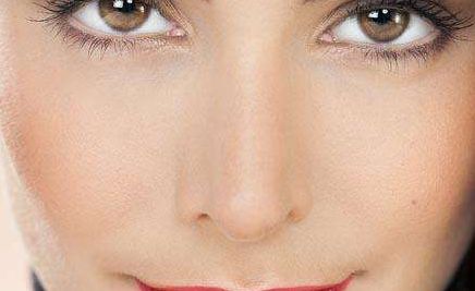 南坊安婷展現(xiàn)精美雙眼皮的絕佳效果