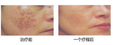 曾昂醫(yī)生的預(yù)約掛號(hào)方式及隆胸日記分享