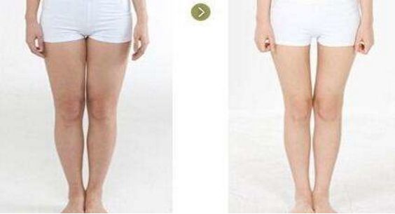 2023年上海副乳吸脂手術(shù)七大名醫(yī)推薦，醫(yī)生排行榜震撼來襲