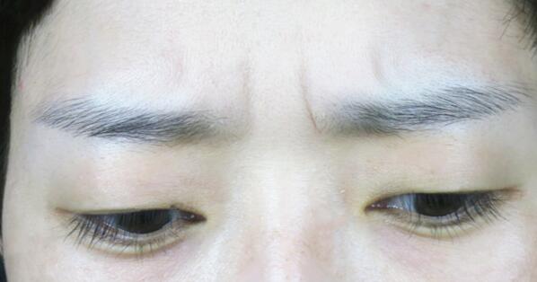 河北醫(yī)科大學第二醫(yī)院項目有哪些？醫(yī)生技術如何提供？