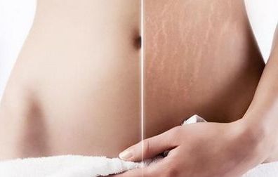 浙江知名隆胸醫(yī)院推薦！這些醫(yī)院廣受好評(píng)