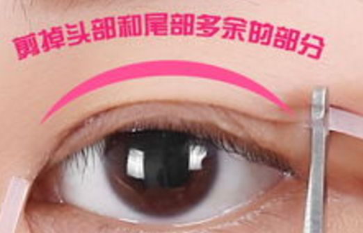 樂山市人民醫(yī)院眼袋手術口碑如何？醫(yī)生推薦+真實案例分析