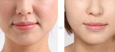 上海最佳隆鼻醫(yī)生推薦！5位實力醫(yī)生值得參考