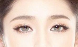 石家莊美聯(lián)臣雙眼皮整形靠譜嗎？有哪些優(yōu)秀醫(yī)生？有什么成功案例供參考？