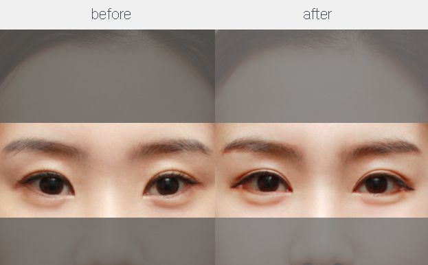 【特約】重慶鼻整形手術(shù)修復(fù)醫(yī)生五強名單揭曉，專家推薦！