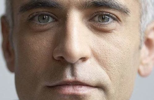 太原魏彤心醫(yī)生釋放雙眼魅力？通過全新案例揭秘獨家技巧！