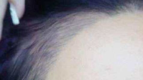 杭州隆胸醫(yī)院，解鎖完美身材，助你歡度自信人生！