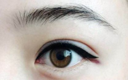 南寧醫(yī)科大雙眼皮整形費(fèi)用及技術(shù)綜述！名單與收費(fèi)指南分享