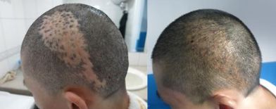 杭州有哪些專業(yè)技術(shù)過硬的鼻修復(fù)醫(yī)院？推薦浙江第二醫(yī)院、薇琳整形醫(yī)院、清鍇醫(yī)療美容中心等