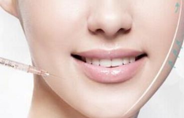 鄭州哪家醫(yī)院割雙眼皮效果好？推薦二附院、華領(lǐng)等夏城里的醫(yī)院！