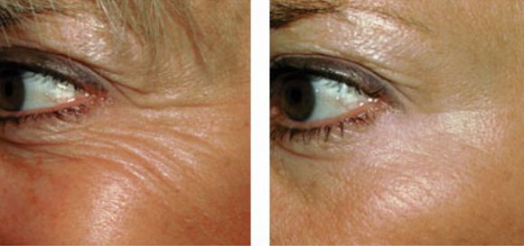 深圳最佳醫(yī)療機構排名，熱瑪吉治療哪家醫(yī)院效果好？