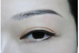 成都鼻頭縮小整形診所推薦！頂尖醫(yī)生揭秘排行榜前三強