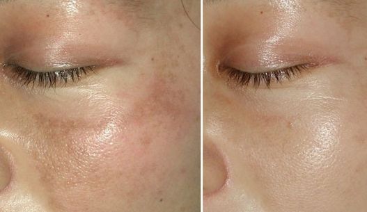 南充優(yōu)質(zhì)眼部整容醫(yī)生推薦，專(zhuān)家級(jí)名醫(yī)榜單發(fā)布