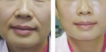 青島鼻修復(fù)：頂級專家實力享譽(yù)！唇齒相依的實力推薦