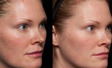 2023年南京磨骨醫(yī)生排行榜！這5位專家大咖讓您眼前一亮！