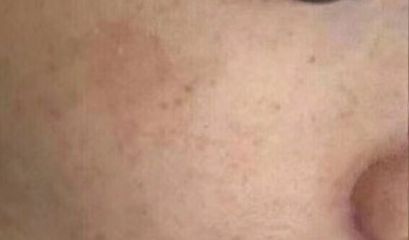 南京優(yōu)質雙眼皮修復醫(yī)生推薦，5位專家點評述評