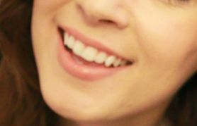 戴傳昌：一位成功鼻部整形案例分享！讓您暢享完美體驗(yàn)！醫(yī)生介紹附上！