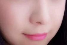 杭州哪家醫(yī)院割雙眼皮效果出眾？推薦藝星、時光、格萊美等受歡迎醫(yī)療機構