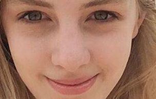 三亞心夢醫(yī)學院醫(yī)師劉濤揭秘受歡迎的吸脂手術案例分享