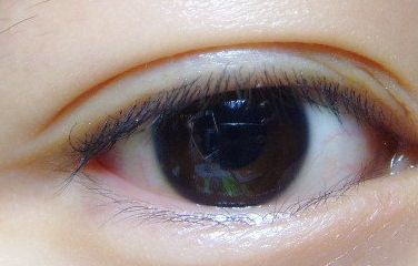 專業(yè)整形醫(yī)生實(shí)力揭秘！解析成都李烈吸脂手術(shù)價(jià)格明細(xì)，分享全面吸脂術(shù)后體驗(yàn)！