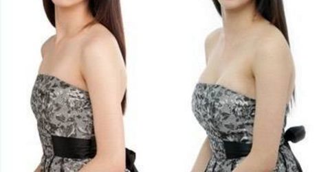 全國哪里可以找到專業(yè)的拉皮手術(shù)醫(yī)生？2023比較好幫手來了！