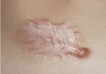 重慶上佳雙眼皮醫(yī)院推薦，口碑高的有這5家！