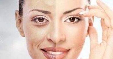 成都賈德淵醫(yī)生的眼睛技術(shù)有何不同？80天變化詳解