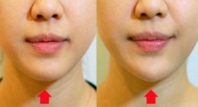 漳州五強(qiáng)醫(yī)院集結(jié)實(shí)力選手，排行榜揭曉！