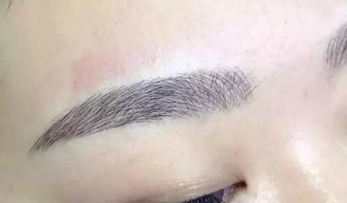 昆明祛斑哪家醫(yī)院更受歡迎？大眾口碑告訴你答案！