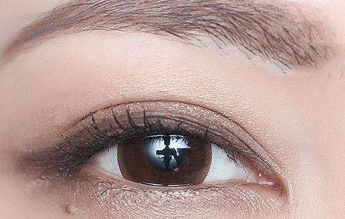 林琳雙眼皮修復(fù)失敗案例分享，術(shù)后視野恢復(fù)亮眼！