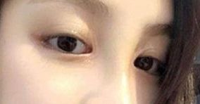 如何選擇合適的醫(yī)生，讓你的身材變得完美無暇