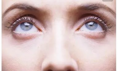 崔向葵雙眼皮整形手術(shù)效果如何？了解一下!