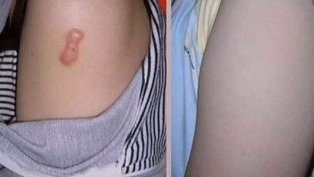 上海知名醫(yī)生手術(shù)CG費(fèi)用曝光，驚人低價(jià)吸引眾多患者！