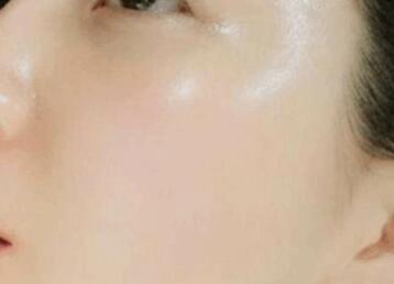 邯鄲有哪些值得推薦的吸脂整形醫(yī)院？整形醫(yī)院的選擇有哪些指標？