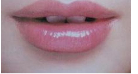 瑞美瑞亞整形醫(yī)院的吸脂案例及口碑盛傳!地址及其綜合評價揭秘!