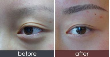 煙臺市區(qū)激光祛斑醫(yī)院排行榜，信譽好的醫(yī)療機構(gòu)高效激光祛斑大解密