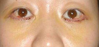 重慶鼻部整形十大備受推崇的醫(yī)生，擔(dān)當(dāng)醫(yī)界翹楚技藝無(wú)敵