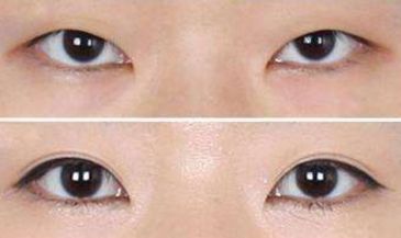 矚目！莊洪興醫(yī)生的綜合評(píng)價(jià)和形象考察