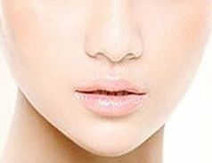 整形技術(shù)首席專家白明，美麗改造雙眼皮效果如何？案例分析大揭秘！